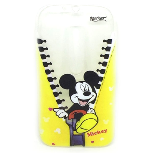 Imagem de Capa para Moto G3 de TPU - Custom Art | Mickey Zíper